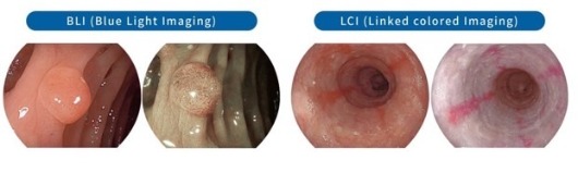 BLI, LCI